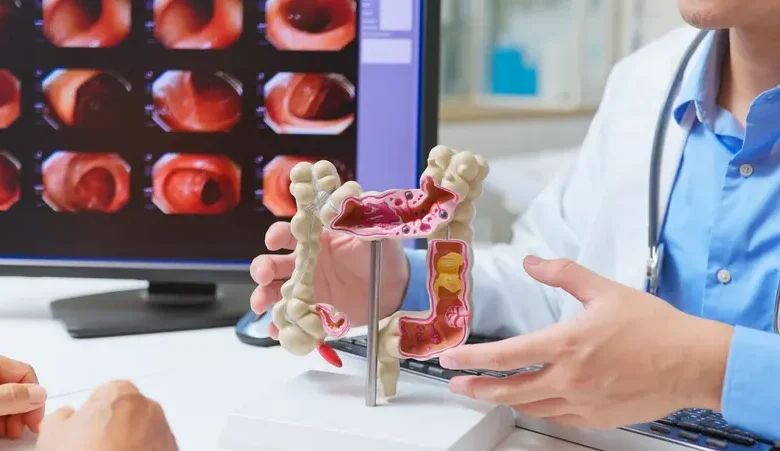 سرطان القولون والمستقيم عند الشباب.. لماذا تتزايد الإصابات وكيف يمكن الوقاية؟