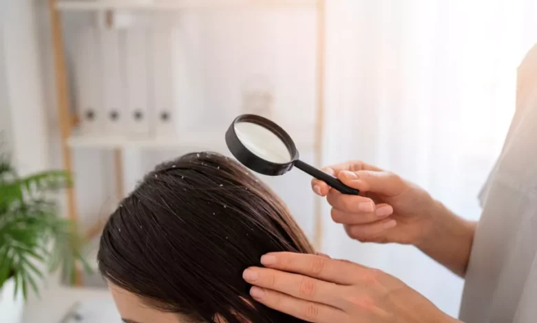 تفسير حلم القمل الأسود للمتزوجة ودلالاته النفسية والرمزية