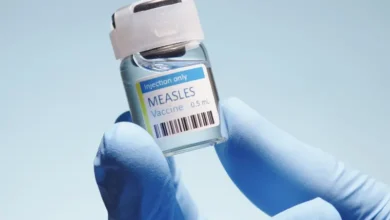 انخفاض التطعيم ضد الحصبة قد يسبب آلاف الإصابات سنوياً.. تحذيرات صحية