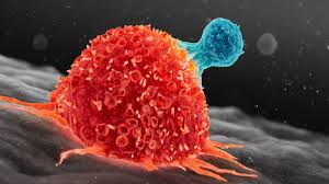 فعالية أدوية السرطان لماذا تنجح لدى البعض وتفشل لدى آخرين؟
