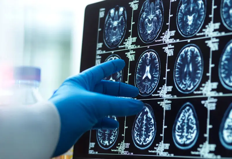  كيف يعمل الدماغ البشري العلم يقترب من فك اللغز