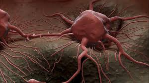 تقدم علمي جديد في العلاج الضوئي الديناميكي للسرطان ينجح في البيئات منخفضة الأكسجين