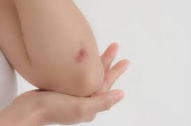 تأثير الوحدة على الصحة هل تبطئ التئام الجروح